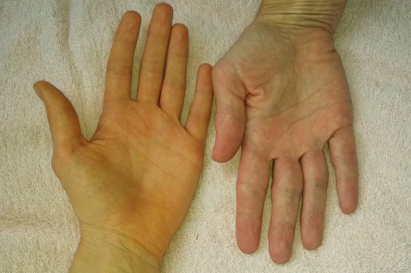 khám sức khoẻ tổng quát cái bè